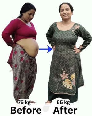 Before and after weight loss transformation by GharParSlim showing successful weightloss at home journey.